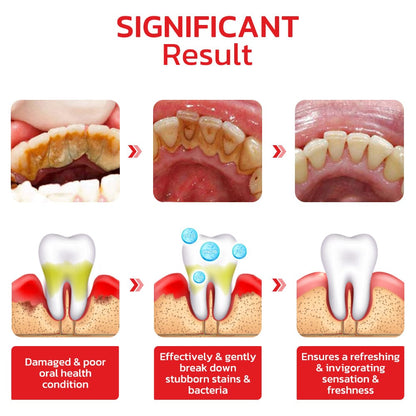 🌟SP-4 Probiotic Intensive Teeth 🦷✨ Whitening Toothpaste 😁 🤩💥SALE FLAT 50% OFF💥🤩